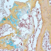 A small bone structure arising from the human skeletal stem cell contains cartilage (blue), bone marrow (brown) and bone (yellow).
